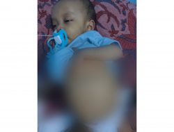Derita Penyakit Langka, Balita Asal Luragung Landeuh Butuh Bantuan